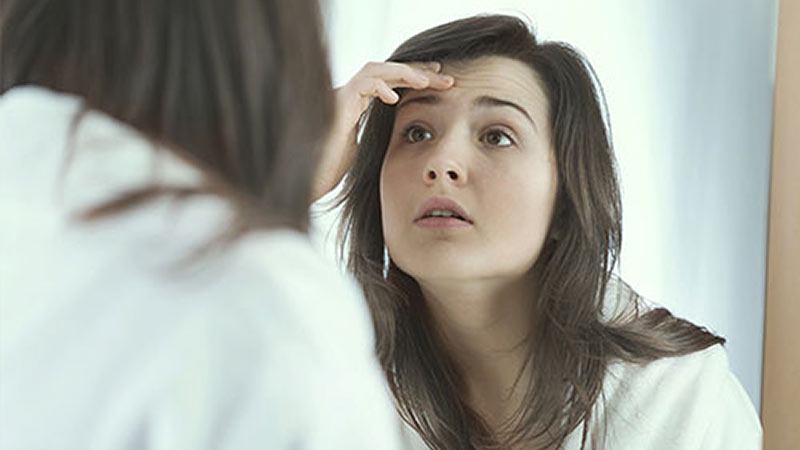 Vitamin A for Acne?