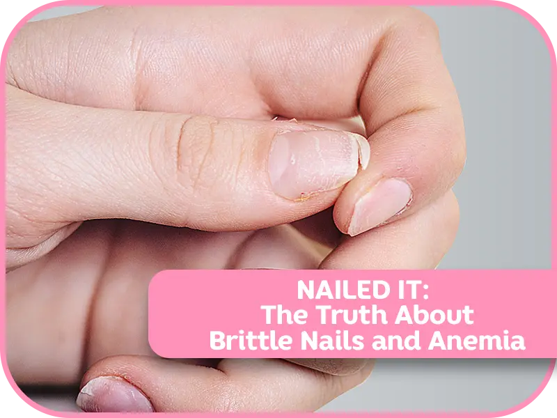 Nailed It: The Truth About Brittle Nails and Anemia