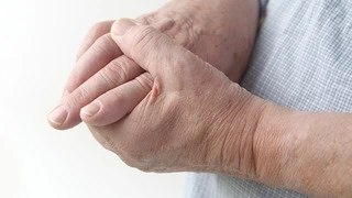 How to Know if You’re Having a Stroke Trivia