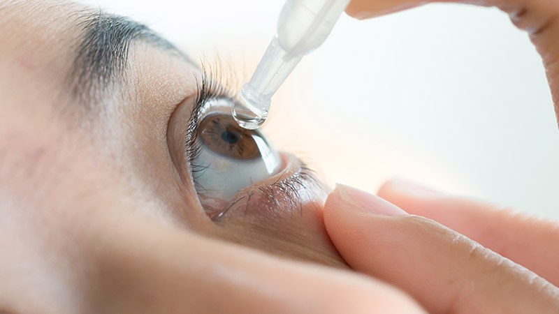 Conjunctivitis: Causes, Prevention, Cure