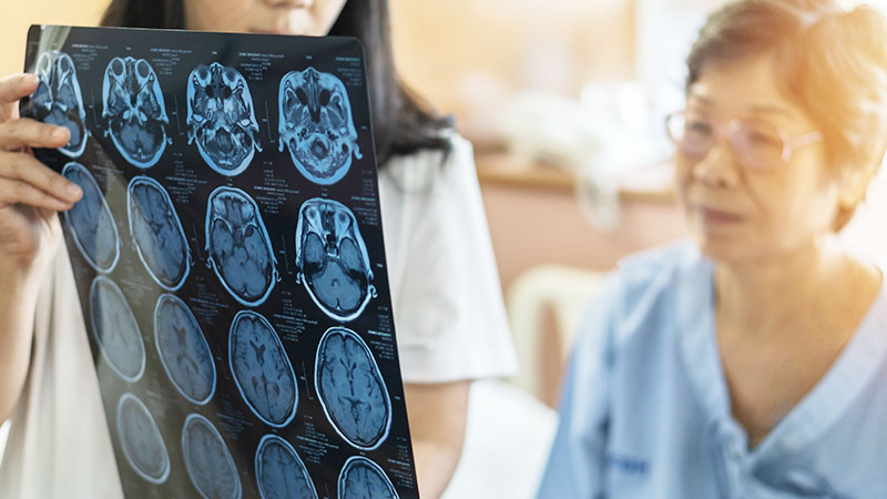 How to Know if You're Having a Stroke