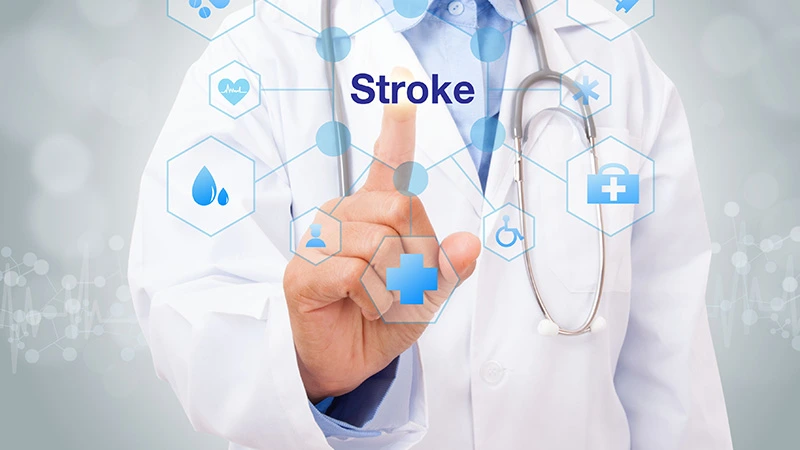 How to Know if Youre Having a Stroke