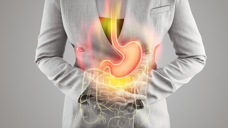 The Connection Between Stress and Stomach Ulcers